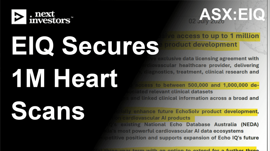 Million-Heart Dataset Deal Positions Australian Startup at Forefront of AI Cardiac Diagnostics Race