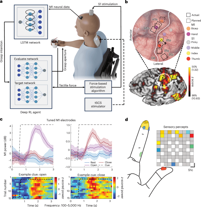 Paralyzed Man Regains Hand Function Through AI-Powered Brain Implant That Rewires the Nervous System