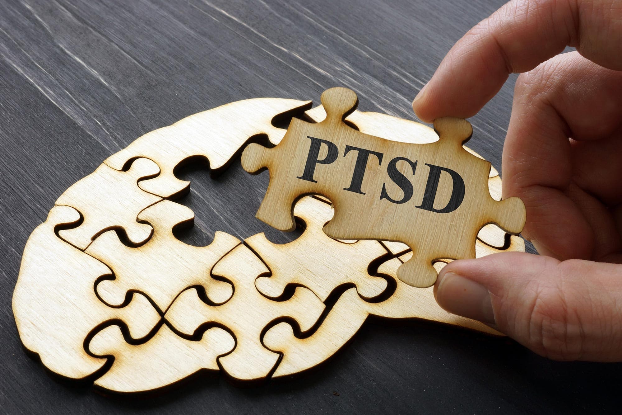 FDA Clears First-of-Its-Kind Nonmedication Treatment for PTSD Using Personalized Brain Mapping