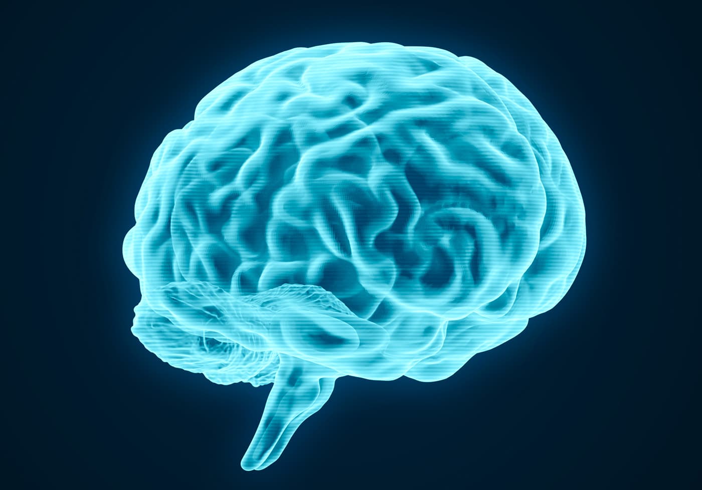 The Double-Edged Sword of AI Radiology: Why Catching More Aneurysms Comes at a Cost
